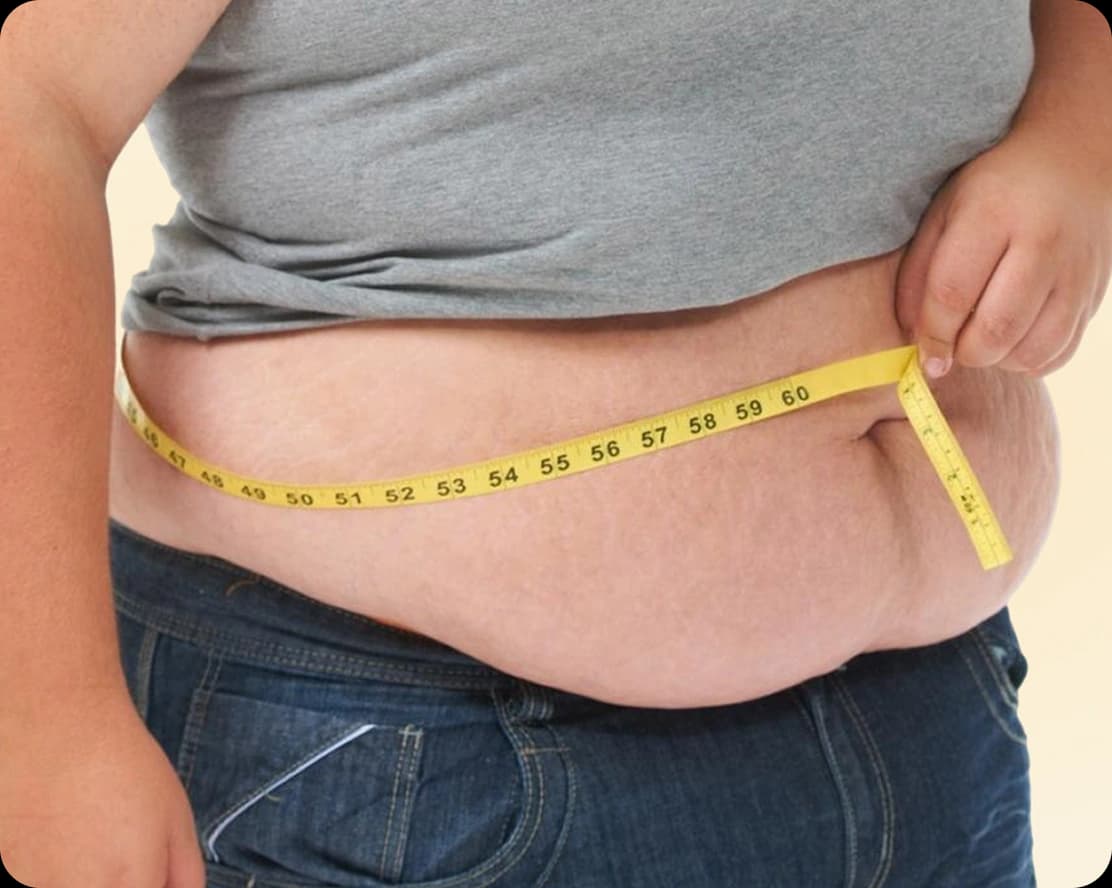 Weight Management