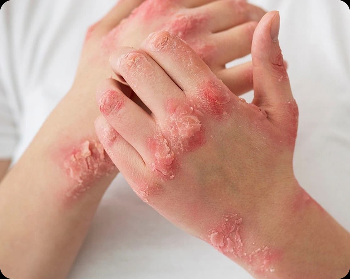 Skin Problems